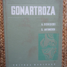 Gonartroza - A. Denischi