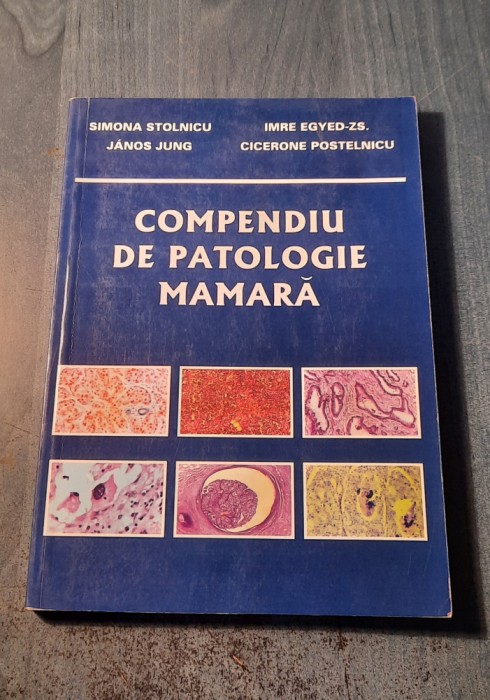 Compediu de patologie mamara Simona Stolnicu