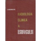 Radiologia clinica a esofagului