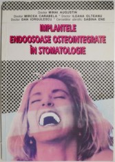 Implantele endoosoase osteointegrate in stomatologie &ndash; Mihai Augustin