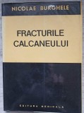Fracturile calcaneului - Nicolae Burghete, Editura Medicala 1978, Carte de Chirurgie, Coperta Cartonata, 206 pagini