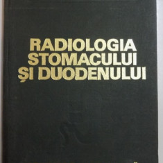RADIOLOGIA STOMACULUI SI DUODENULUI de I. PANA , M. VLADAREANU , 1975 , PREZINTA HALOURI DE APA