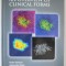 AMD AN OVERVIEW OF CLINICAL FORMS by OUDY SEMOUN ...THE OPHTHALMOLOGY CRETEIL TEAM , ANII &#039;2000