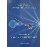 Tumorile vezicale superficiale - Catalin Schiop