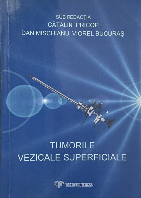 Tumorile vezicale superficiale - Catalin Schiop foto