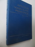 Afectiuni vasculare periferice - Tiberiu Ghitescu