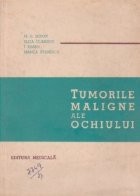 Tumorile maligne ale ochiului foto