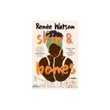 Skin &amp; Bones