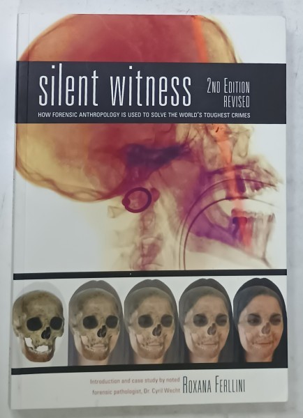 SILENT WITNESS , HOW FORENSIC ANTHROPOLOGY IS USED TO SOLVE THE WORLD &#039; S TOUGHEST CRIMES by ROXANA FERLLINI , 2012