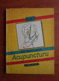 Acupunctura - M. J. Guillaume