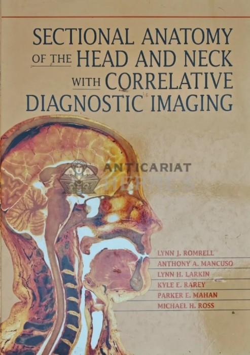Sectional anatomy of the head and neck with correlative diagnostic imaging - 1994 - Anthony A. Mancuso (Y244)