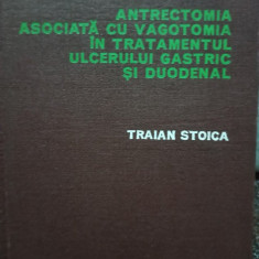 Traian Stoica - Antrectomia asociata cu vagotomia in tratamentul ulcerului gastric si duodenal (1978)