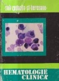 Hematologie clinica (Berceanu)