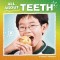 All about Teeth