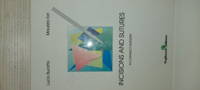 Incisions and sutures in cataract surgery foto