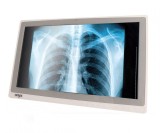 Cumpara ieftin All-In-One medical Onyx ZEUS-228ST, 22 inch FHD Multi-Touch, i7-6600U pana la 3.9 GHz, 8GB DDR4 RAM, 128GB SSD, WI-FI, BT, RS-232, DVD-RW