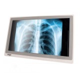 All-In-One medical Onyx ZEUS-228ST, 22 inch FHD Multi-Touch, i7-6600U pana la 3.9 GHz, 8GB DDR4 RAM, 128GB SSD, WI-FI, BT, RS-232, DVD-RW