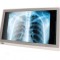 All-In-One medical Onyx ZEUS-248ST, 24 inch FHD Multi-Touch, i7-6600U pana la 3.9 GHz, 16GB DDR4 RAM, 256GB SSD, WI-FI, Win 10 PRO
