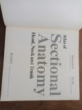 Atlas of sectional anatomy, HEAD, NECK SAND TRUNK- McGrath* Mills, 1984