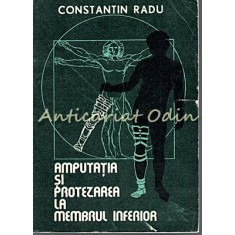 Amputatia Si Protezarea La Membrul Inferior - Constantin Radu