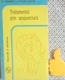 Tratamentul prin acupunctura C. Ionescu-Tirgoviste
