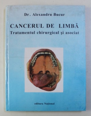 CANCERUL DE LIMBA , TRATAMENTUL CHIRURGICAL SI ASOCIAT de ALEXANDRU BUCUR , 1998 foto