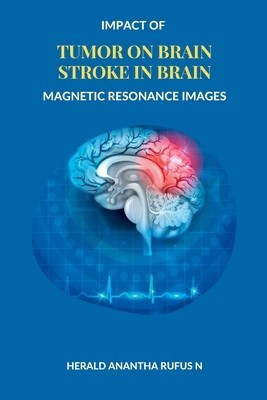Impact of Tumor on Brain Stroke in Brain Magnetic Resonance Images foto