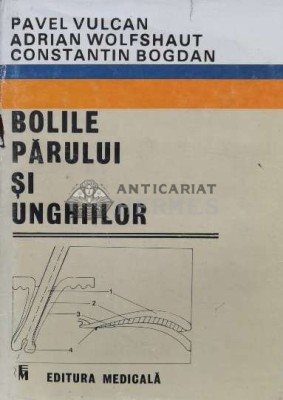 Bolile parului si unghiilor - 1989 - A. Wolfshaut (M86) foto