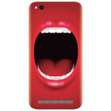 Husa silicon pentru Xiaomi Redmi 4A, Big Mouth