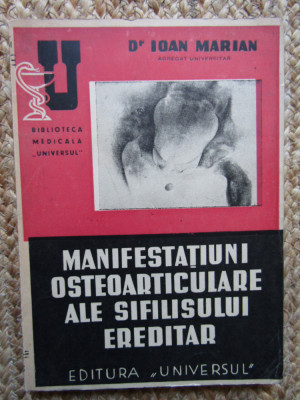 MANIFESTATIUNI OSTEOARTICULARE ALE SIFILISULUI EREDITAR de Dr. MARIAN , 1945 foto