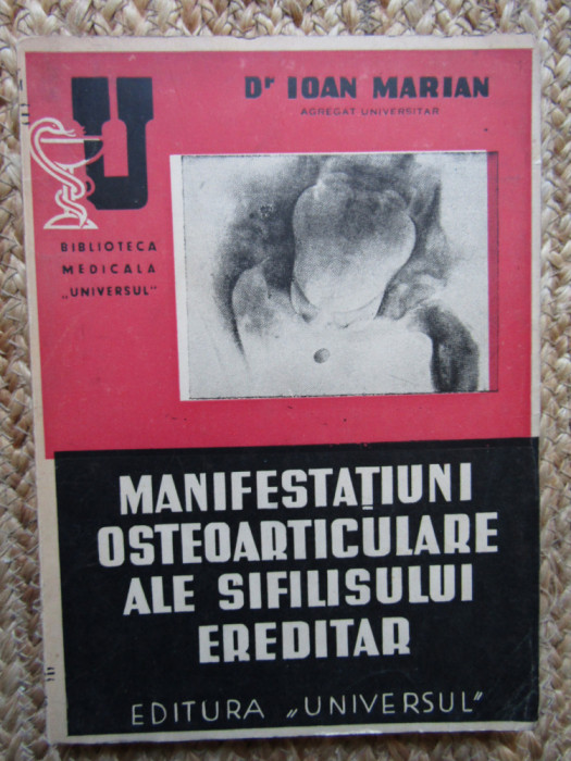 MANIFESTATIUNI OSTEOARTICULARE ALE SIFILISULUI EREDITAR de Dr. MARIAN , 1945