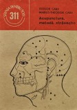 Cumpara ieftin Acupunctura, metoda straveche - 1989 - Marius-Theodor Caba ($R30)