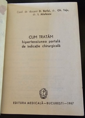 Cum tratam hipertensiunea portala de indicatie chirurgicala foto