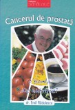 AS - DOCTOR EMIL RADULESCU - CANCERUL DE PROSTATA