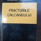 Fracturile calcaneului- Nicolae Burghele