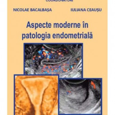 Aspecte moderne in patologia endometriala - Nicolae Bacalbasa, Iuliana Ceausu