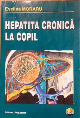 Hepatita cronica la copil foto