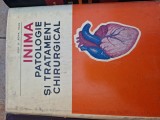 Inima patologie și tratament chirurgical