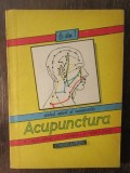 ACUPUNCTURA-M.J. GUILLAUME