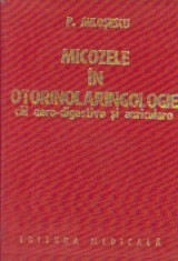 Micozele in otorinolaringologie - cai aero-digestive si auriculare foto