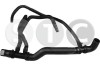 STC T409577 Furtun radiator