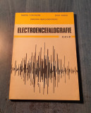 Electroencefalografie ghid Sebastian Neagu Sadoveanu