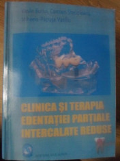 CLINICA SI TERAPIA EDENTATIEI PARTIALE INTERCALATE REDUSE (XEROX) - VASILE BURLU foto