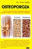 Tom Smith - Osteoporoza