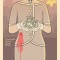 Trouble with Lichen
