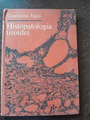 HISTOPATOLOGIA TIROIDEI , CONSTANTIN TASCA foto