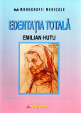 Edentaţia totală - Paperback brosat - Emilian Huţu - Naţional