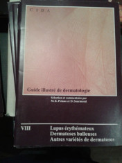 VIII-LUPUS ERYTHEMATEUX,DERMATOSES BULLEUSES,AUTRES VARIETES DE DERMATOSES-CIBA foto