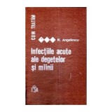 N. Angelescu - Cum tratam infectiile acute ale degetelor si mainii - 111426