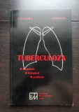 TUBERCULOZA. Diagnostic. Tratament. Profilaxie - P. Panghea, O. Bercea